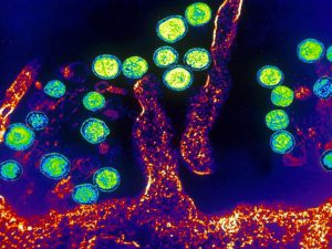 通过电子显微镜看到的汉坦病毒细胞膜内粒子